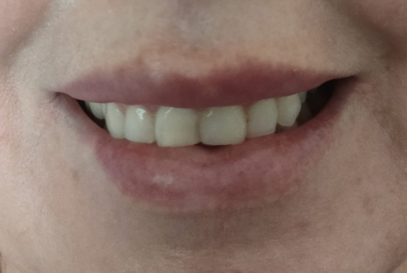 Sourire après le soin