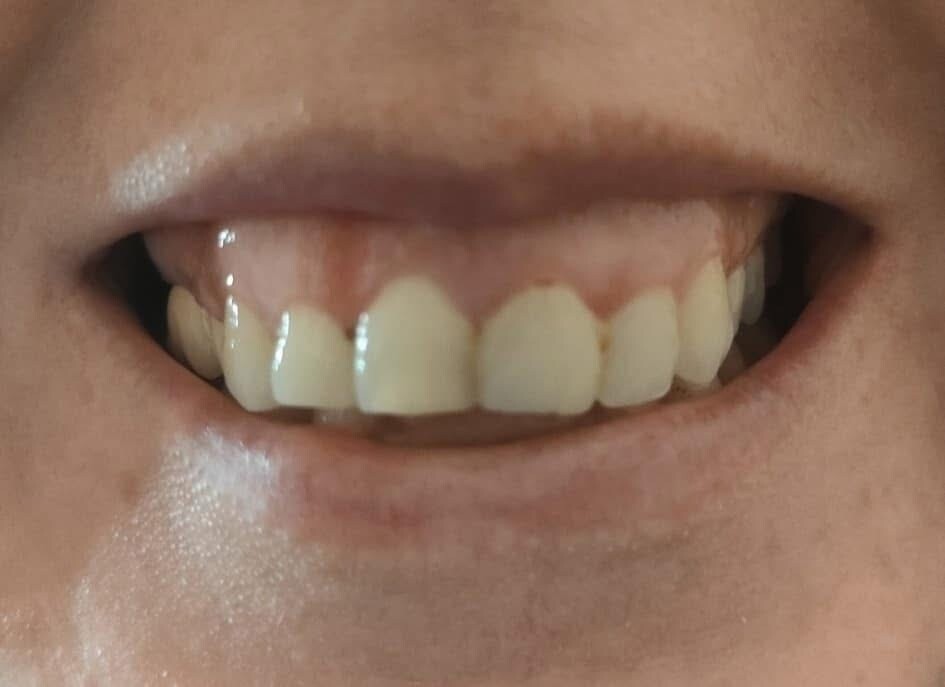 Sourire avant le soin